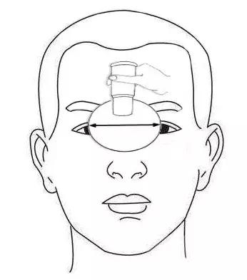 青少年近视艾灸哪些穴位,赵氏雷火灸治近视