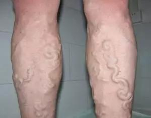 香蕉割包皮,洋葱剖腹产?这是我见过最秀的医生