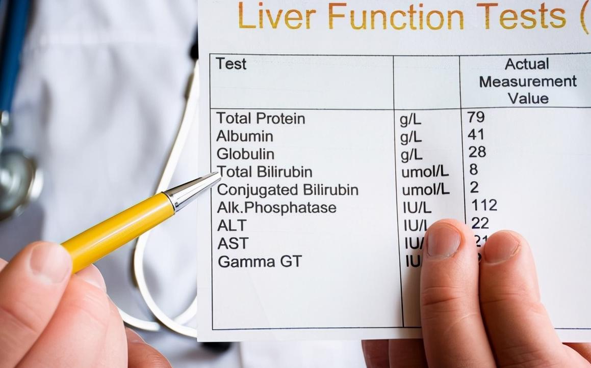 体检报告看不懂31种指标,体检报告看不懂