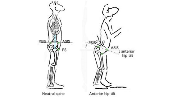 硬拉背不稳老是想弓腰,硬拉弓背腰反而不疼为什么