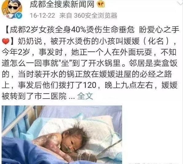 孩子发生意外烫伤的处理顺序,又被烫伤了怎么处理才有效