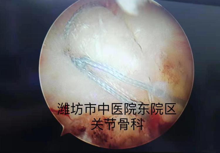 潍坊哪个医院看肩周炎比较好,潍坊中医院颈肩腰腿疼专家