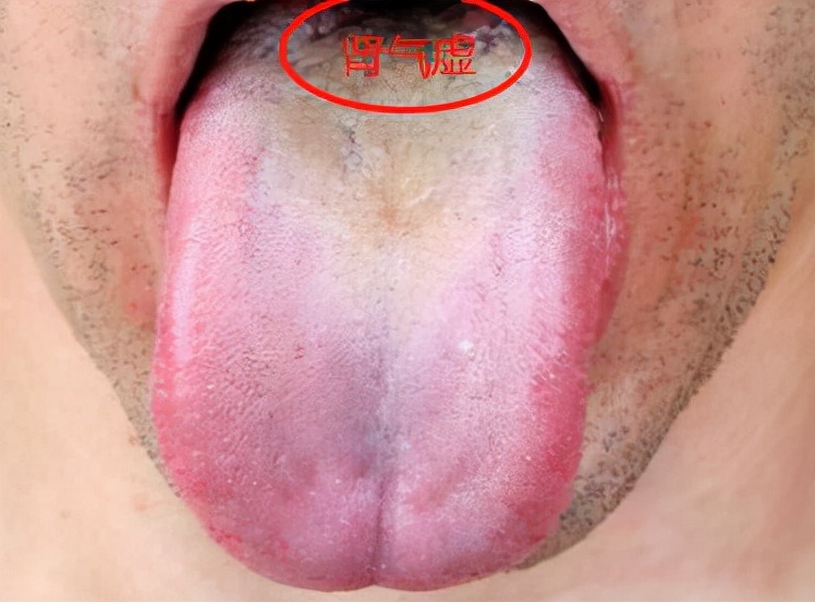 肾气虚金匮肾气丸,金匮要略肾气丸原方解读