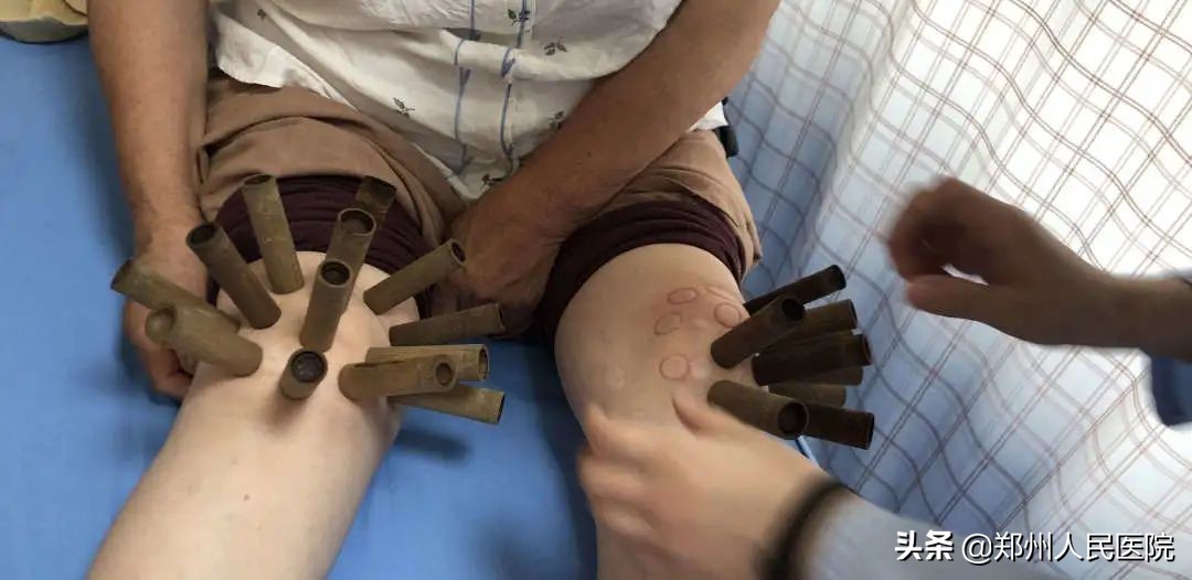 胳膊肿能自愈吗,下手臂肿了一般能自愈吗