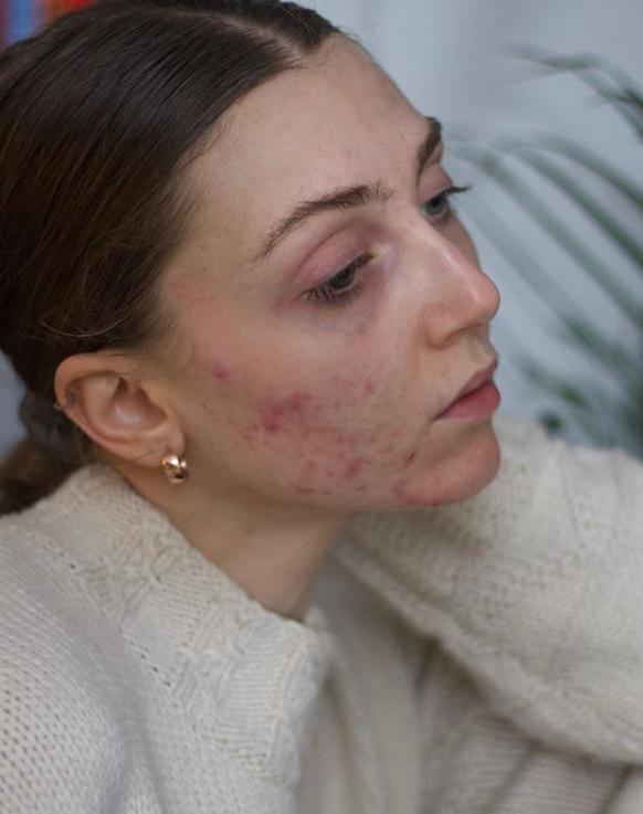 濂崇敓鐖嗙棙蹇呬拱娓呭崟鑽啅,鐖嗙棙浜у搧蹇呬拱娓呭崟