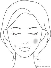 要肌肤像剥了壳的鸡蛋？你对斑了解多少？