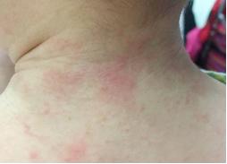 这支小青膏真的好！我带俩娃来为它正名