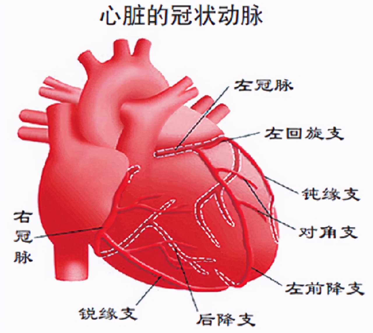冠心病要静养还是多运动,冠心病人需要什么类型的运动