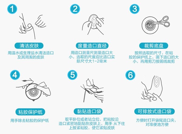 造口患者的心理,造口人真的存在心理障碍吗