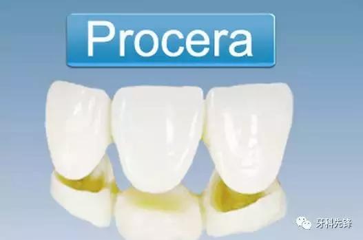烤瓷牙和全瓷牙的优缺点是什么,钴铬合金烤瓷牙和全瓷牙优缺点