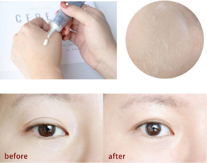 眼部常见问题有哪些,常见眼部问题