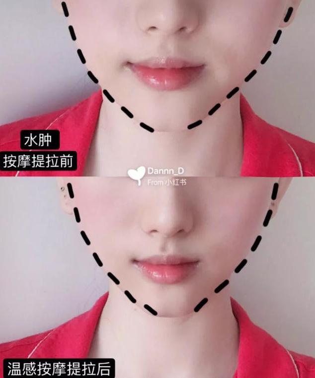 美容仪是智商税还是真的有效果,美容仪是智商税吗值得购买吗