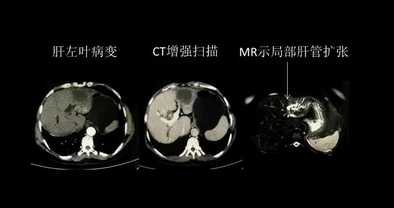 黄疸要做肝脾彩超吗,黄疸需要做颅脑彩超吗