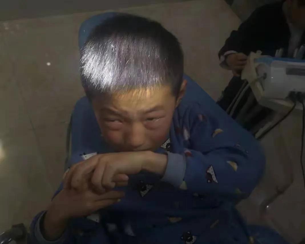 孩子吃糖牙疼怎么治,孩子吃糖牙疼怎么快速缓解