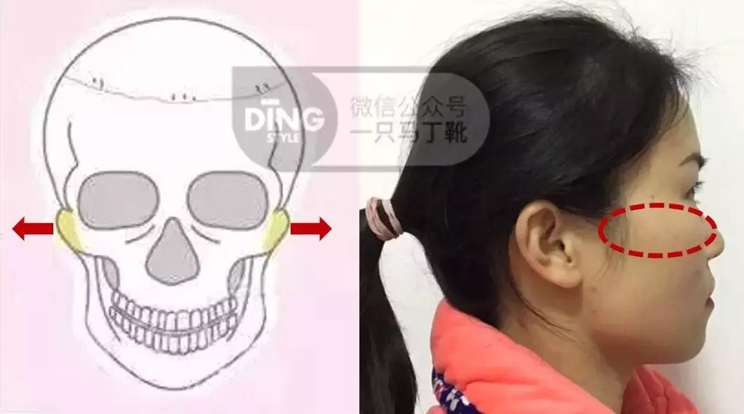 扁头怎么让头变得饱满些,扁头怎么办最快最有效