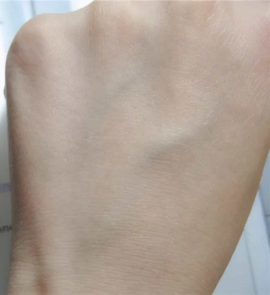 医学博士说眼霜真的治疗黑眼圈吗,真正对黑眼圈有用的眼霜