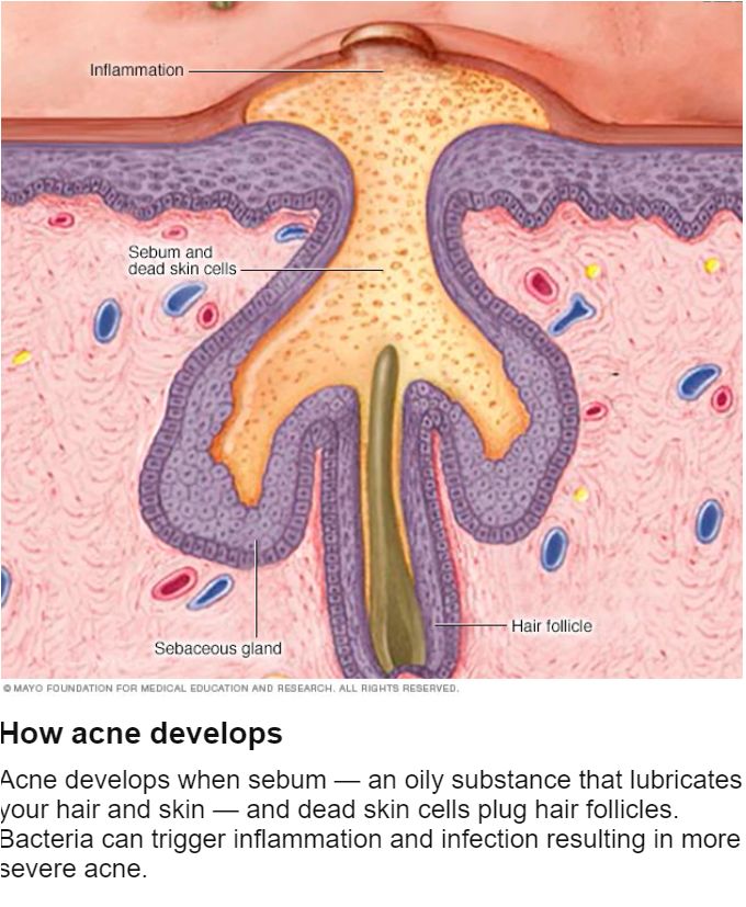 治疗口内生疮用什么偏方,疮疡的症状及治疗方法