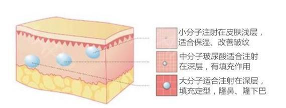 张歆艺用的什么填充脸部,张歆艺填充脸部前后对比