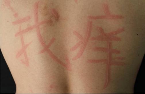 治疗皮肤瘙痒的有效药物是啥,皮肤瘙痒用什么药膏无激素