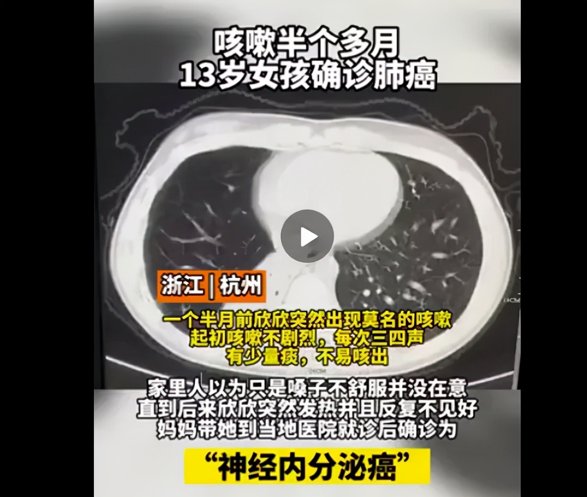 孩子又咳嗽了要不要用药,小孩又咳又喘吃什么止咳药