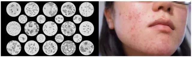 超临界蜂胶与普通蜂胶有几大优点,纯天然蜂胶的作用与功效