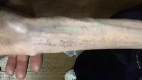 21岁少女“自杀式”减肥,智商税到底还要交多少?