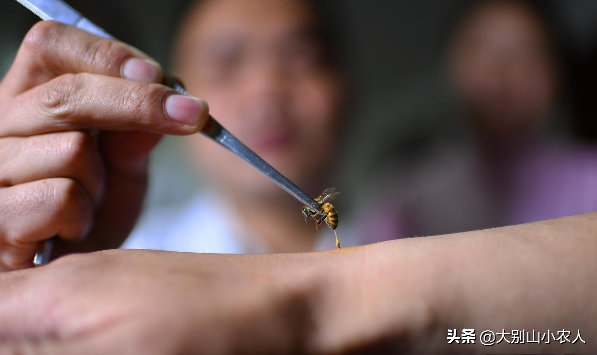 马蜂被蜇死亡,摘马蜂窝挂树上24小时殒命