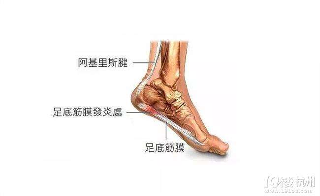 腿直腰直不起来怎么办,腿不直怎么办快速解决