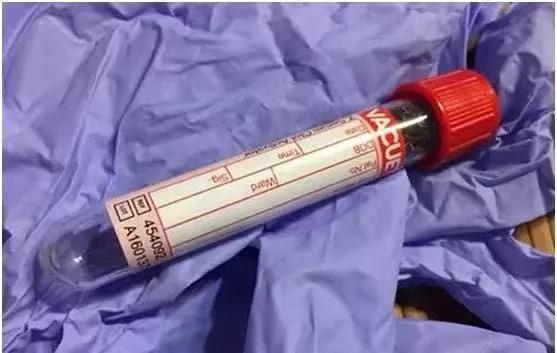 这份身体指标对照表太全了,这份体检指南请查收