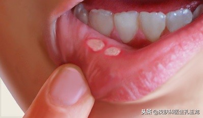 微量元素锌有什么作用,人体对微量元素锌的吸收率高吗