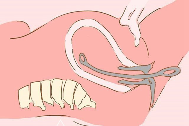 女人超过三次流产会有哪些危害,女性一般流产次数是多少