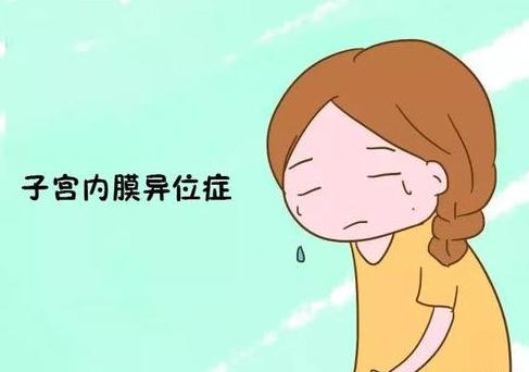 子宫内膜异位症手术费用大概多少,子宫内膜异位症针灸需要几个疗程