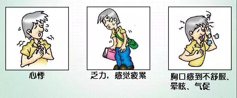 心律失常55分钟讲解,心律失常心电图讲解视频教程全集