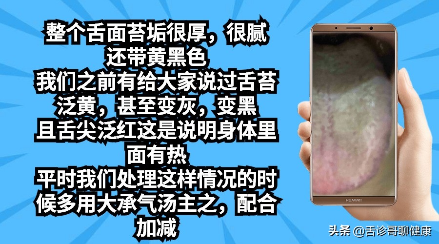 抖音舌诊哥舌象感悟：强迫症、大便不成型、忧心忡忡