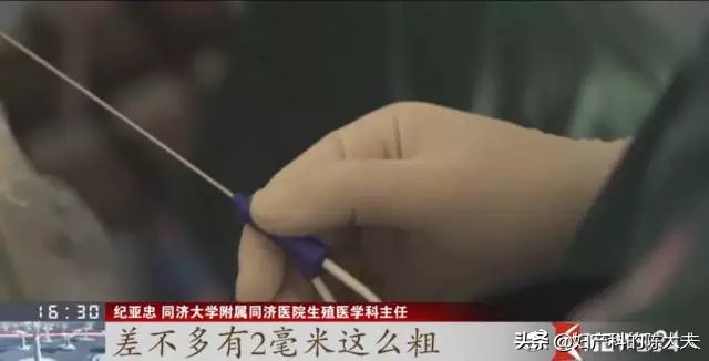 女性试管成功率多大,试管婴儿女性要遭受多大的罪