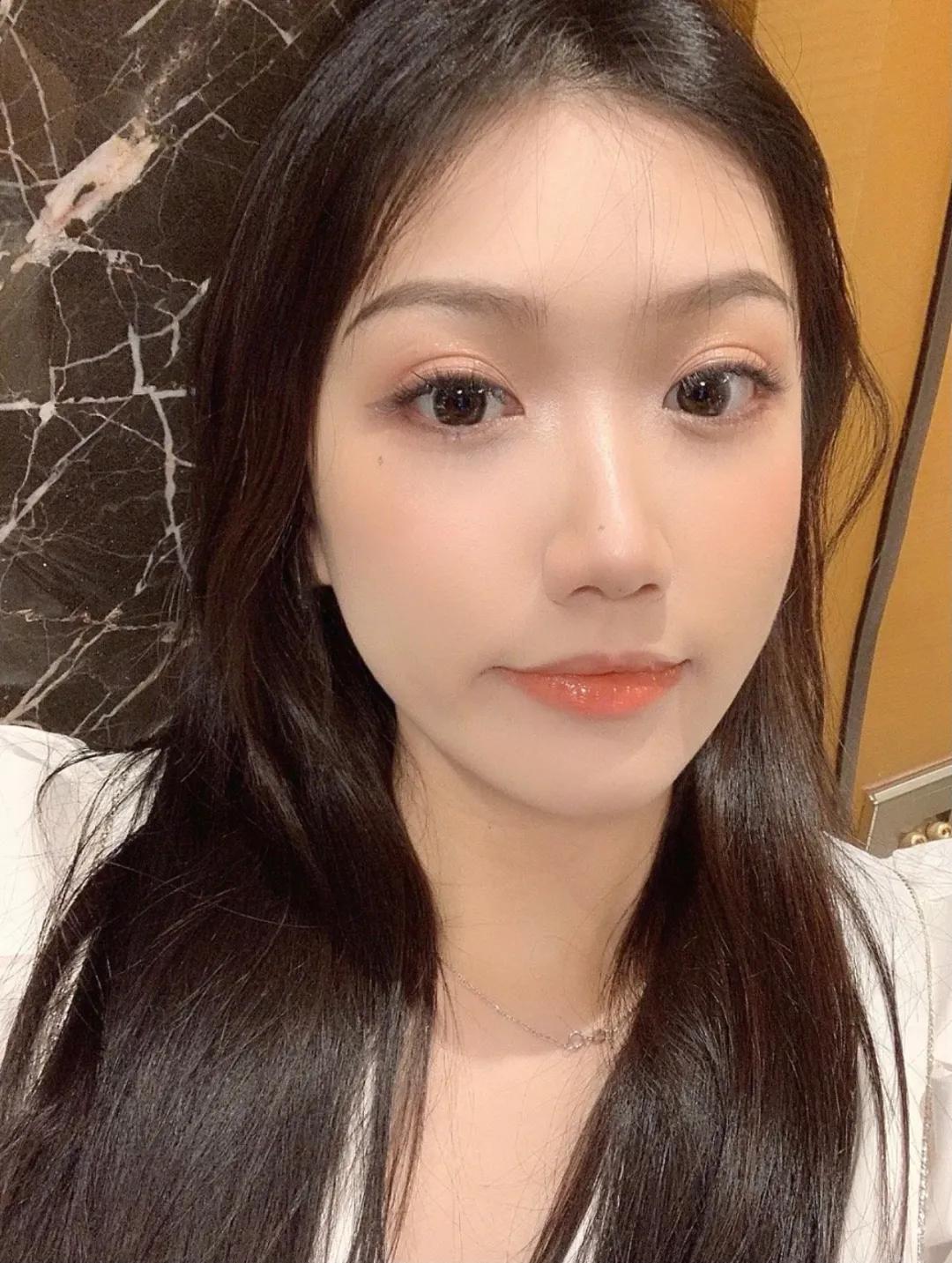 全脸点痣变美,点痣能变美吗