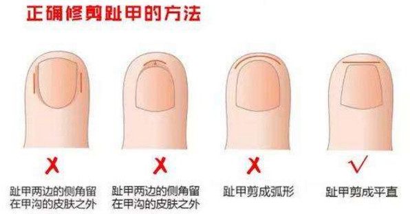 给宝宝修剪指甲正确的方法,用指甲剪给宝宝修指甲的危害
