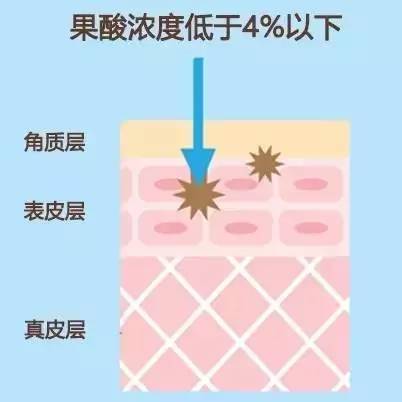 如何解决四种不同类型的黑头,3招教你搞定真假黑头