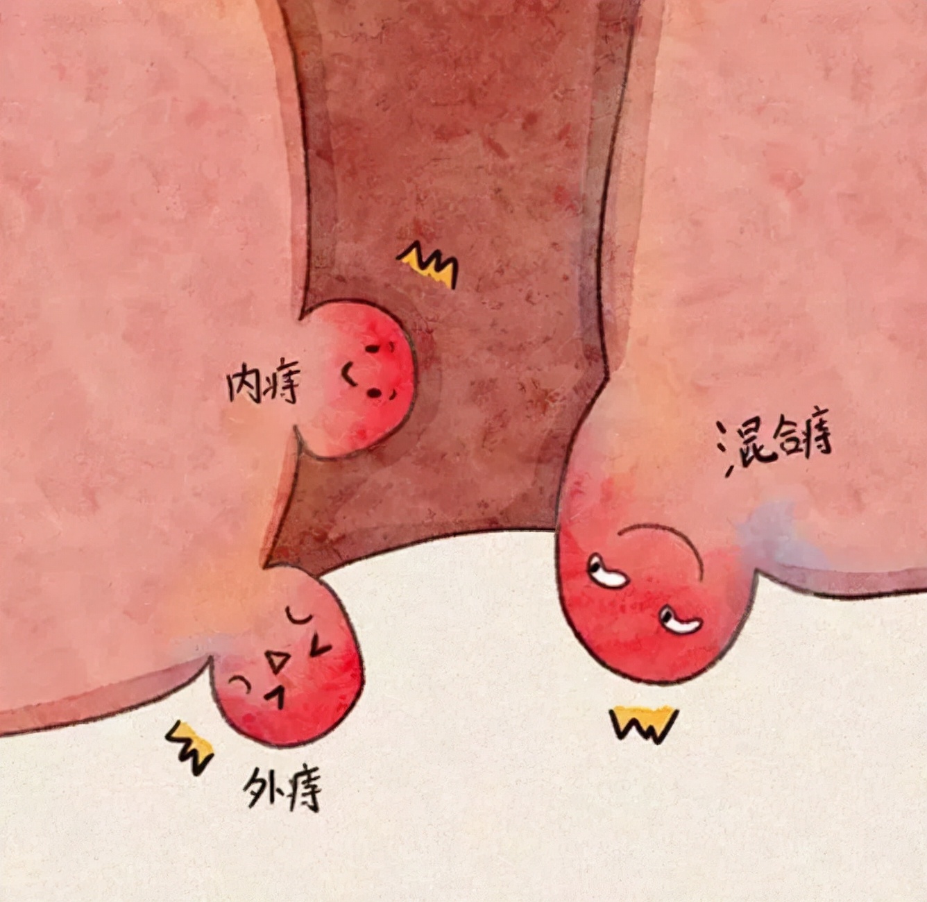 坚持提肛的好处是什么？