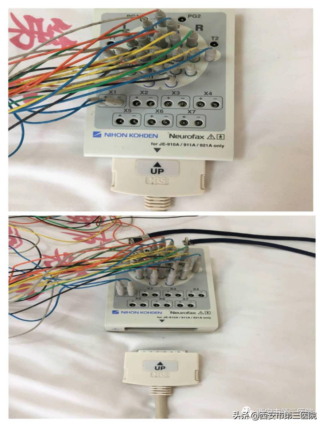 医者纪录片癫痫后续,医者纪录片解读