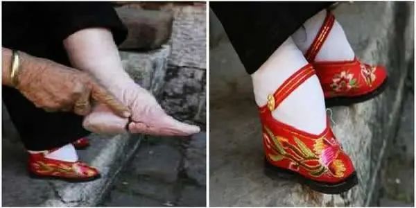 束腰带到底能不能瘦腰,束腰带真的能瘦腰吗