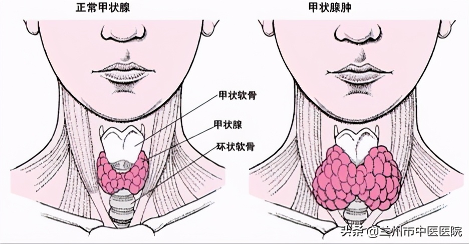 肿瘤医院联盟揭牌仪式,甘肃肿瘤医院甲状腺治疗
