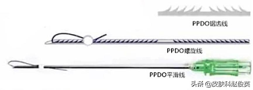 埋线科普视频,埋线美容方法视频