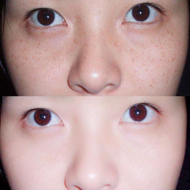 防晒仅仅只是为了防晒黑吗？不是！这些问题你要了解