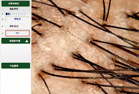 比较好用的德国防脱发,德国十大最好用的护肤品