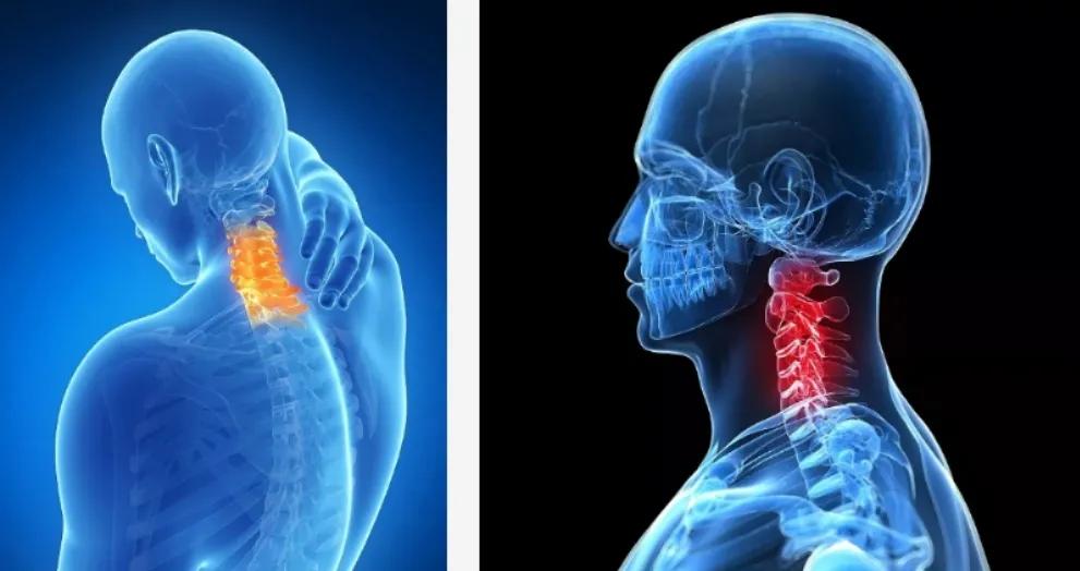 颈椎病常见护理问题,颈椎病患者一定别做这件事