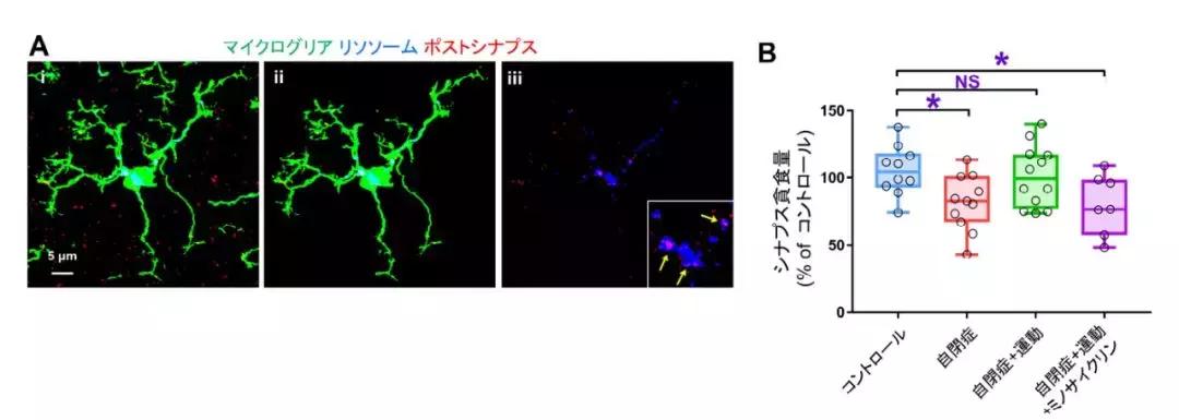大量的运动可以改善自闭症吗,日本自闭症康复技术