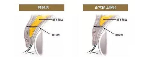 单眼皮肿眼泡眼妆3ceovertake,overtake眼影单眼皮肿眼泡眼妆教程