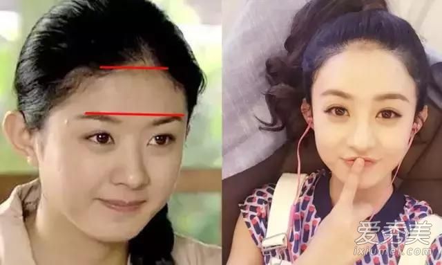 发际线太低显脸大,发际线低怎么办适合什么发型