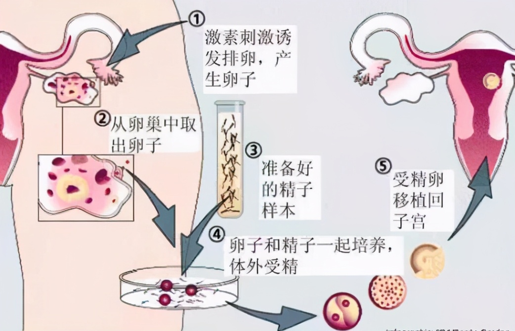 代孕法律问题研究,谈谈对代孕事件的看法